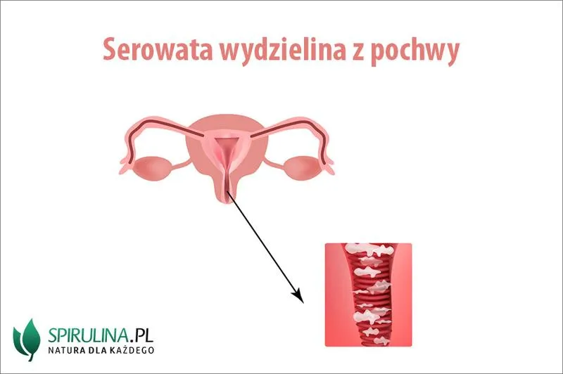 Rodzaje wydzieliny z pochwy